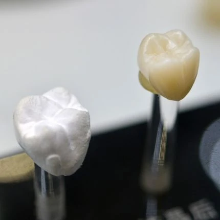Peças protéticas em formato de coroas dentárias
