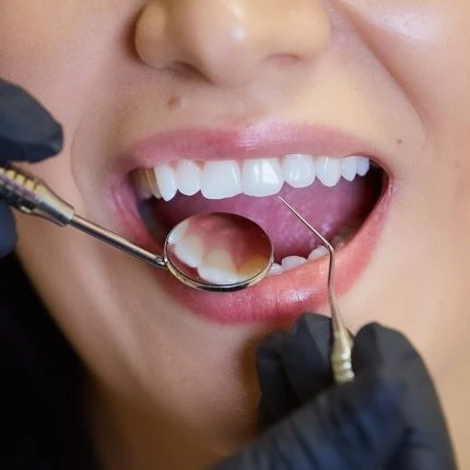 Avaliação de um sorriso com espelho odontológico