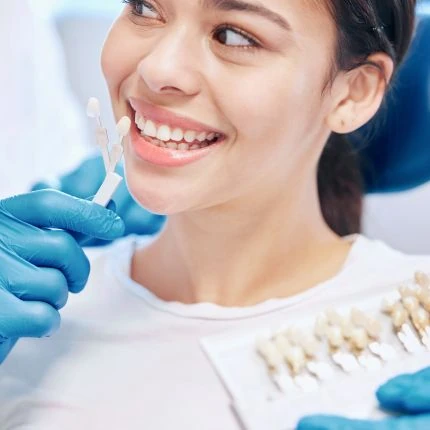 Escala de cores utilizada no planejamento estético do sorriso