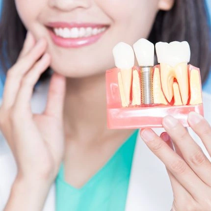 Modelo odontológico mostrando um implante entre dentes naturais